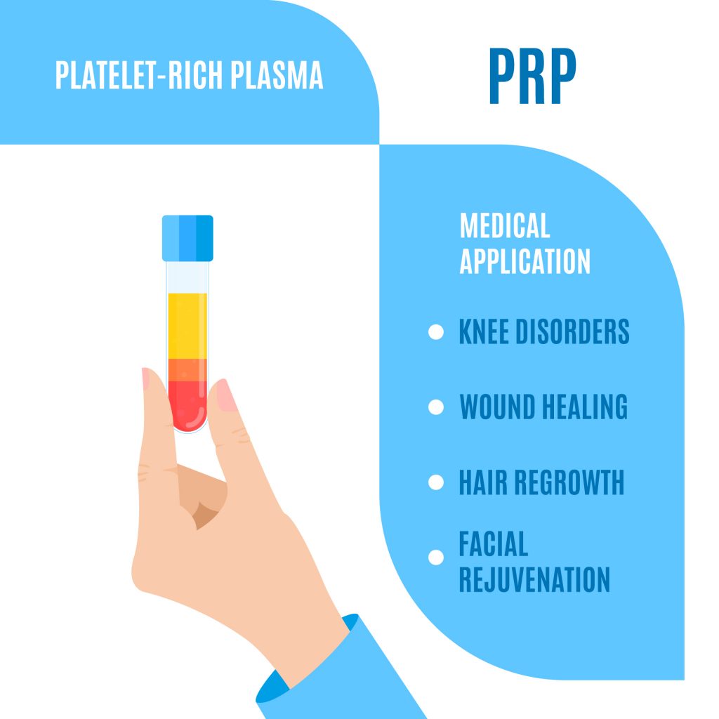 Platelet-Rich Plasma - Regenerative Medicine